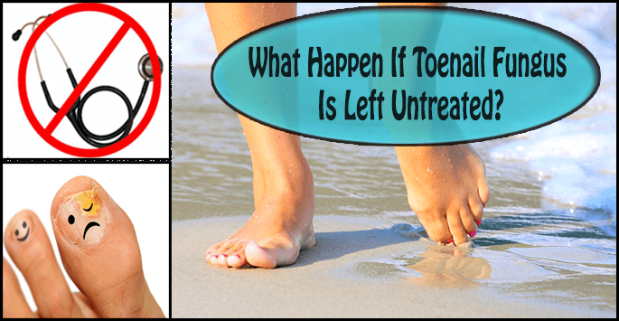 How to heal toe fungus