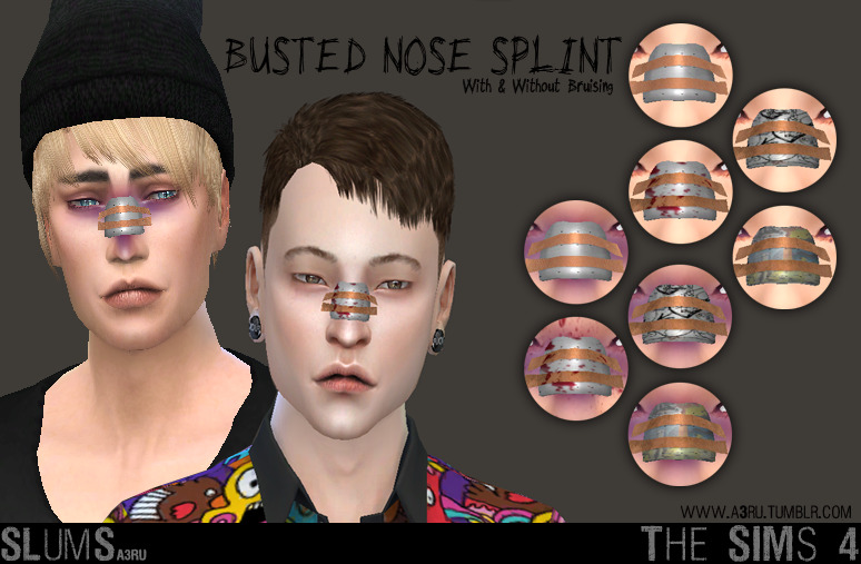 Sims 4 facial bruises