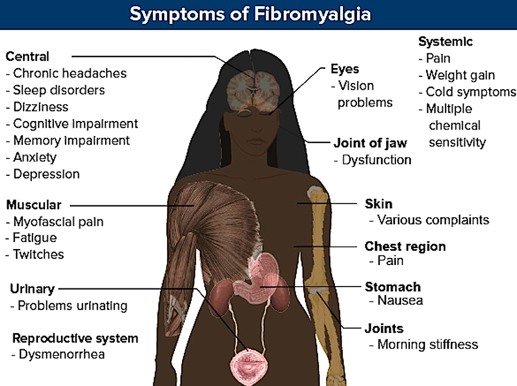 Фибромиалгия симптомы причины и лечение