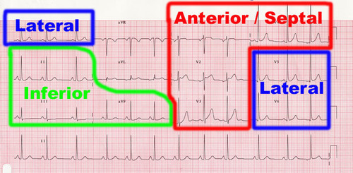 My Notes For Usmle — Basics For The Wards How To Read Ekgs