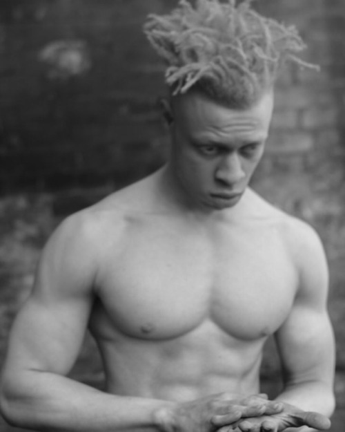 Naked Albino Men Naked Albino Men
