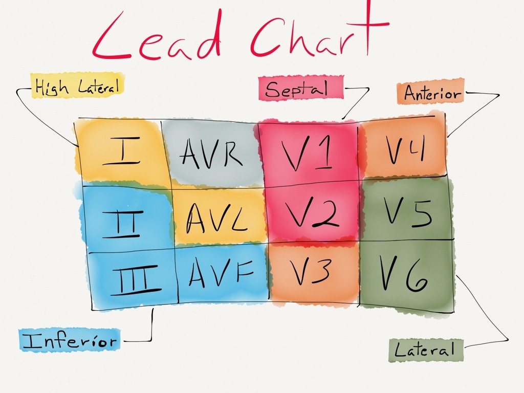 12 Lead Chart