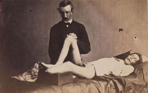 Union Private John Parmenter under anaesthesia, 21 June 1865....