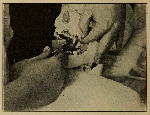 nemfrog:In America the dead receive better dental care than...