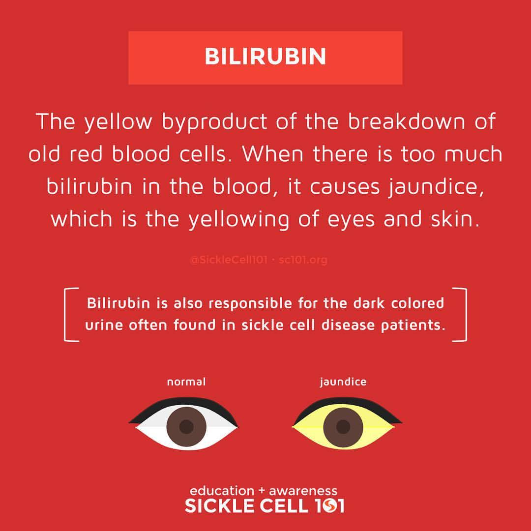 SICKLE CELL 101 — Bilirubin is a substance produced by the...