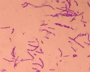 Bacillus anthracis infection