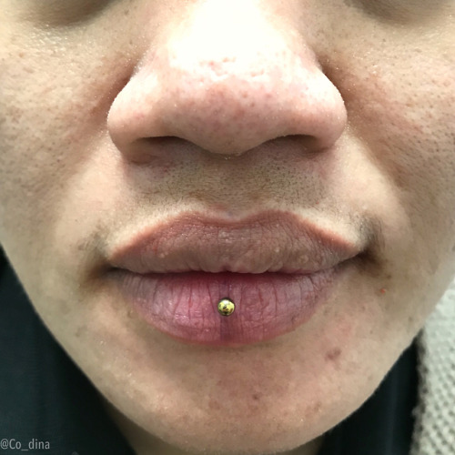 codymatthewpiercing:Fresh Inverse lip piercing from...