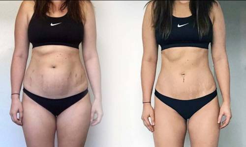 Video motivacion adelgazar barriga