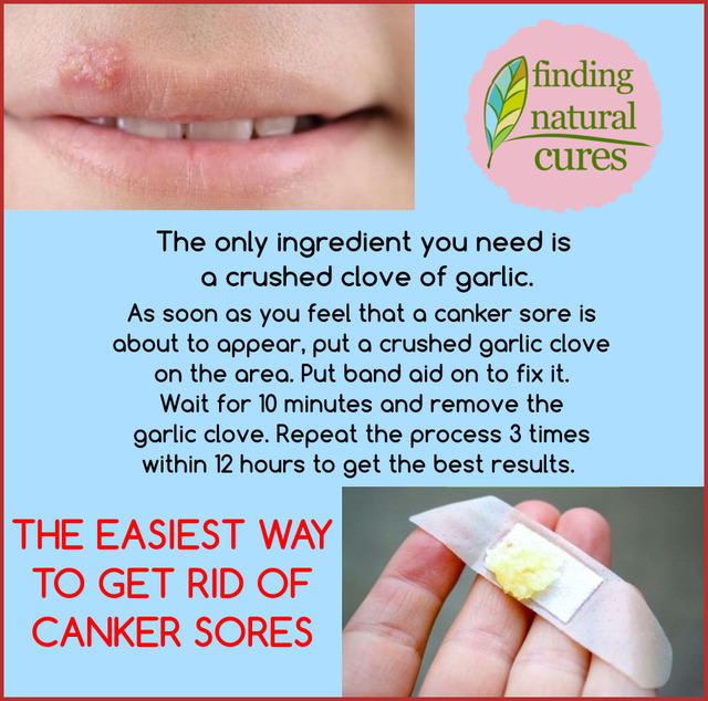 Finding Natural Cures — The easiest way to get rid of canker sores...