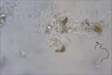 Капля слюны. Бактерии под микроскопом. Бактерии в капле воды. Микроскоп бактерии гиф. Микробы в воде gif.