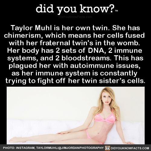 taylor-muhl-is-her-own-twin-she-has-chimerism