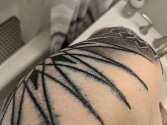 BME/Risks: Extreme Tattoo Ink Bleeding - BME: Tattoo, Piercing and Body  Modification NewsBME: Tattoo, Piercing and Body Modification News