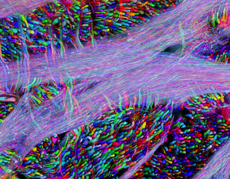 The Micro and Macro of the Universe. — “Brainbow” mouse brain stem with ...