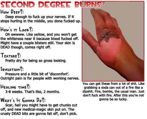 second vs third degree burns