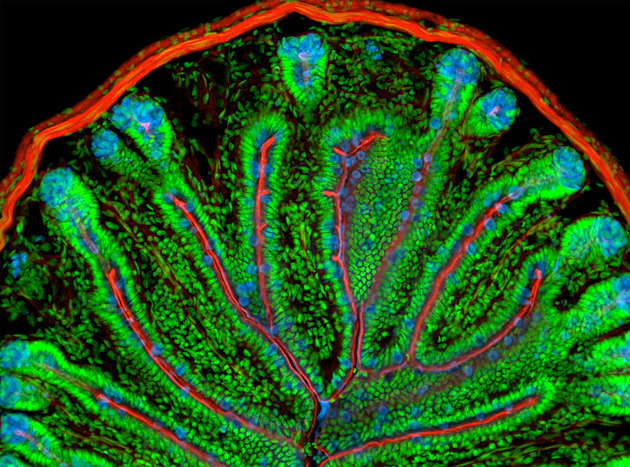 a Fractured Reality • Murine Intestine This cross section of a mouse...