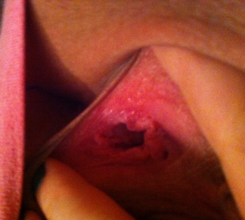 My mini pussy gape. I love my pussy being stretched and used I...