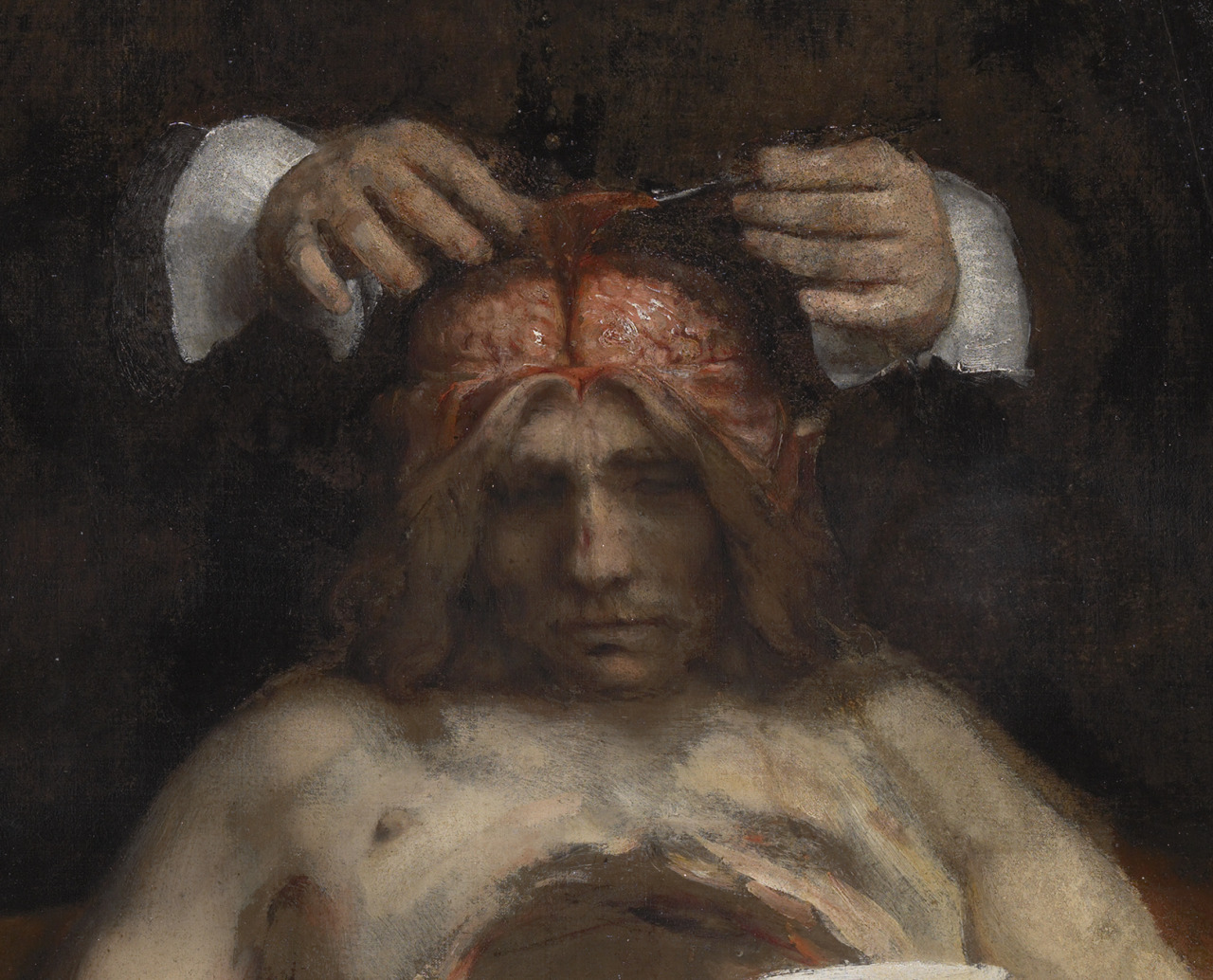 achasma:
“The Anatomy Lesson of Dr. Jan Deyman (detail) by Rembrandt van Rijn, 1656.
”