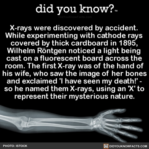 did-you-kno:X-rays were discovered by accident. While...