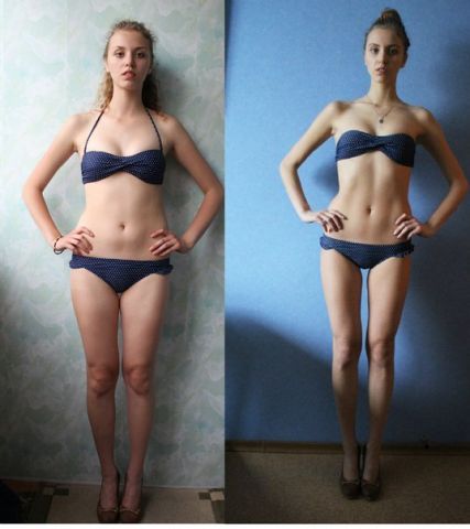 makeme-skinnier:Before and After Thinspoyou could be like this...