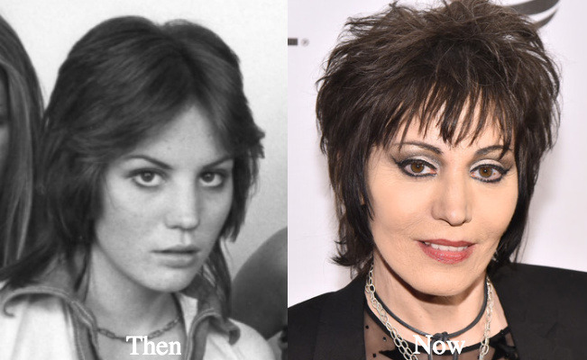 All Thing Plastic Joan Jett Plastic Surgery Before And After Photos