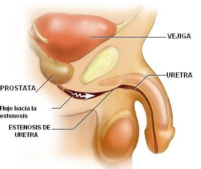 prueba de antígeno prostático específico significa en hindi prueba de antígeno prostático específico significa en hindi