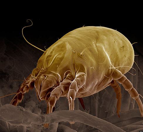 News of UC San Diego Health Sciences — Mite Makes Flight Judged by its ...