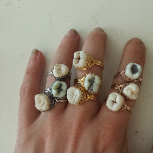 thegolddig:Sweet tooth ring(more information, more etsy gold)