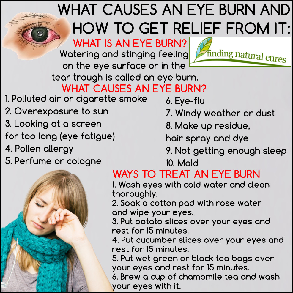 sunburned eyeballs treatment