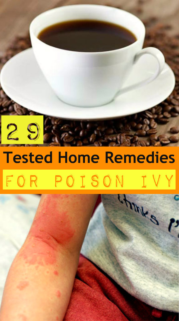 home remedies for poison ivy