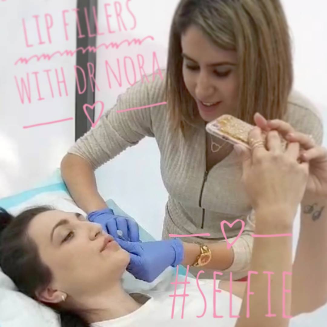 Just finished a lip filler treatment at Medcentres (@medcentres.com.au) with my wonderful #selfie snapping patient who was topped up with 1ml of HA based filler to bring fresh #vavavoom to her beautiful lips.
If you have any questions, feel free to...