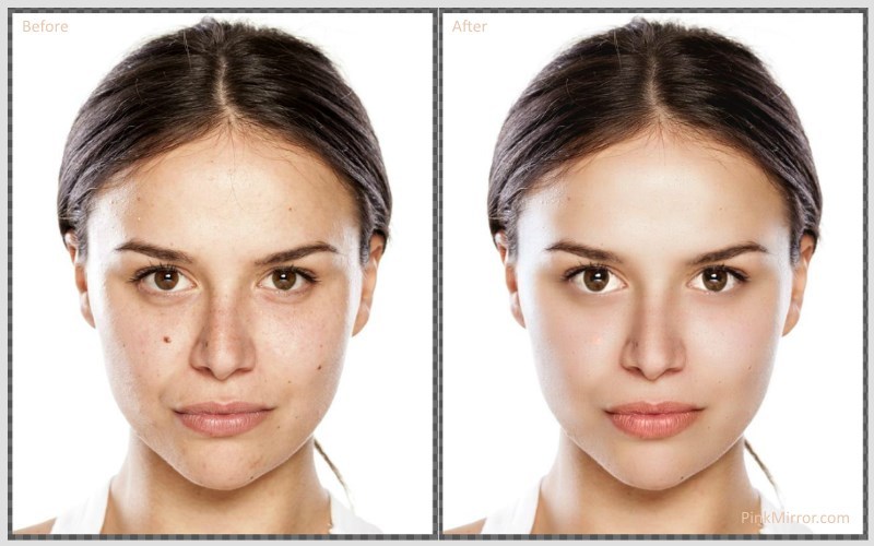 Before After Facials Tumblr