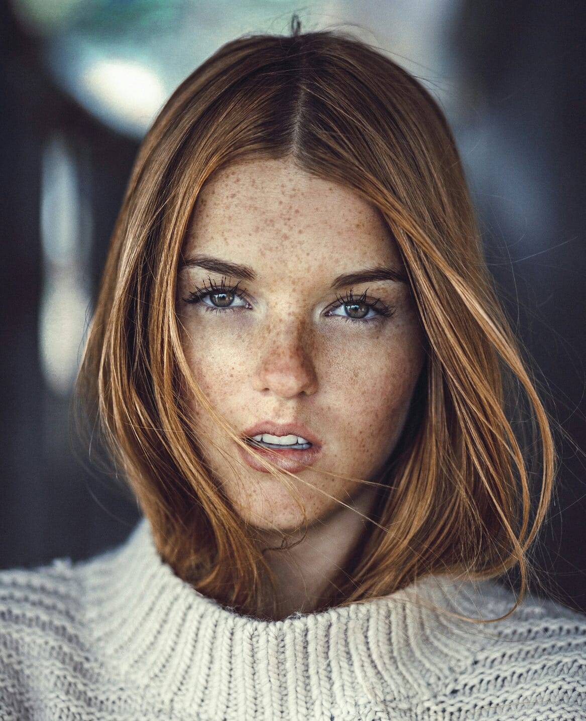 Hairy Freckles