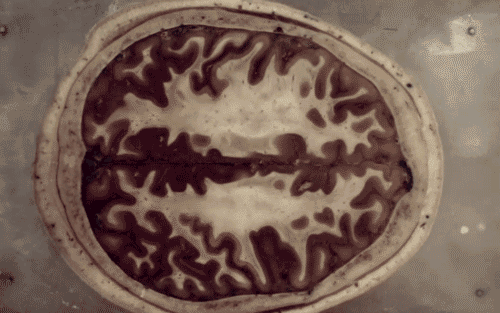 medicalschool:
“ The human brain in cross section
”