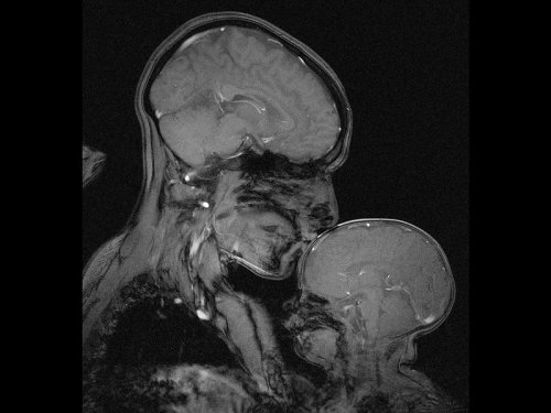 definitely something i will try to do! neuroscience mri neuro psychology psychblr sbposts eveincollege heystudiyng heysareena etudiance academla elkstudies hawkstudies science biology anatomy studycubs heygen article studybuzz intellectus sixpenceee areistotle studypetals studyblrsofcolor