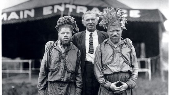 lostinurbanism:  Harriet Muse, right, and husband, Cabell, far left, with the brothers shortly after she found them at a sideshow in 1927. Photograph by George Davis. The brothers were kidnapped from their home in Virginia to become circus performers.