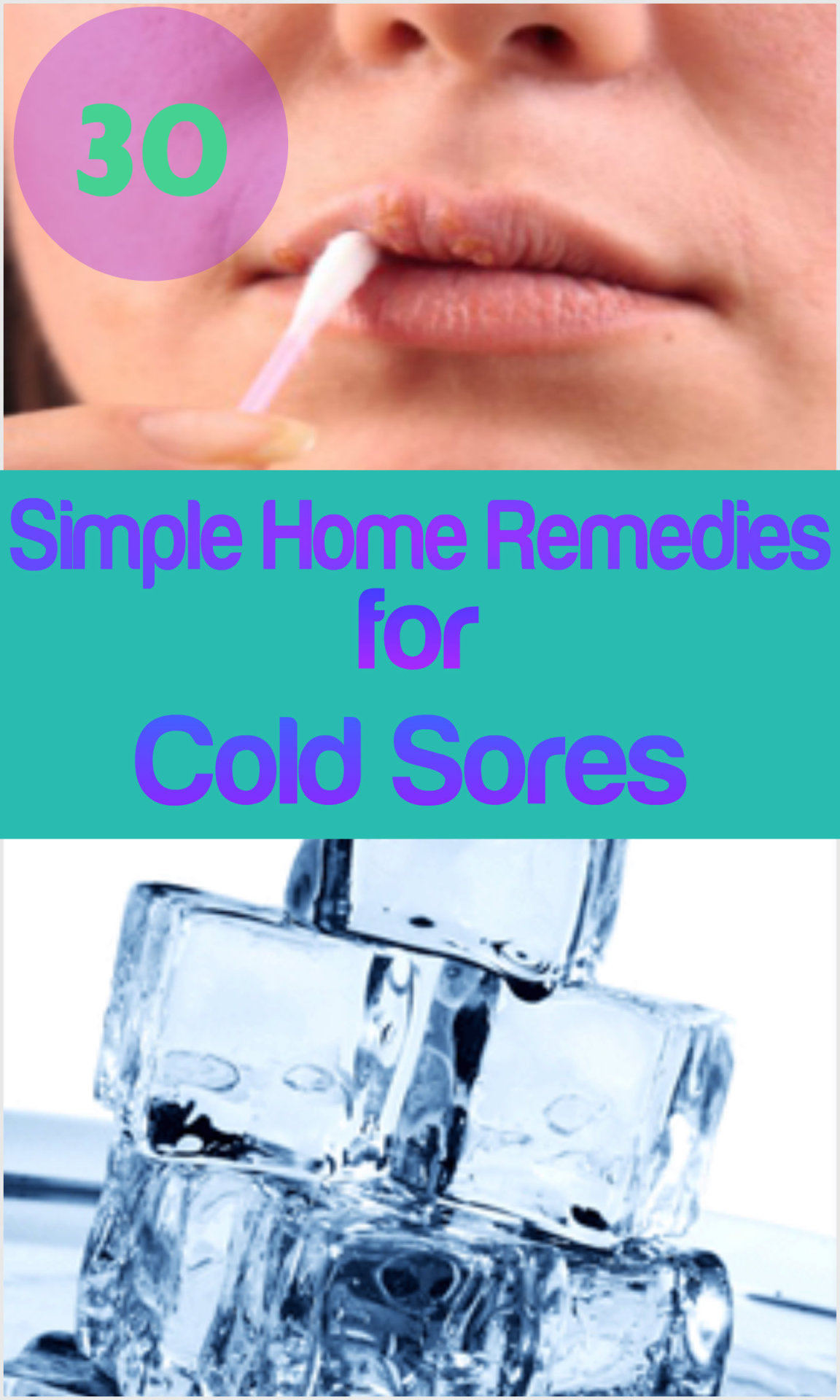 home-remedies-store-30-simple-home-remedies-for-cold-sores