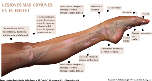 Resultado de imagen para que lesiones q el de ballet