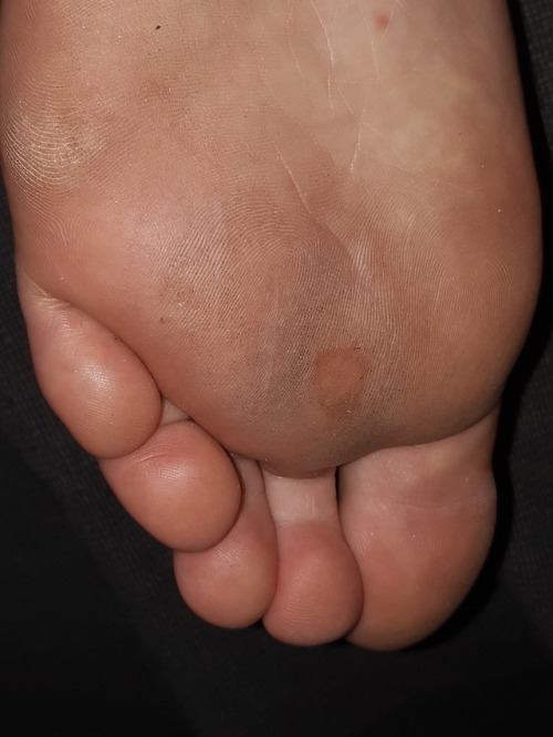 Girlfriend’s dirty feet