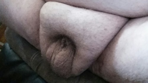Extra hole in penis she