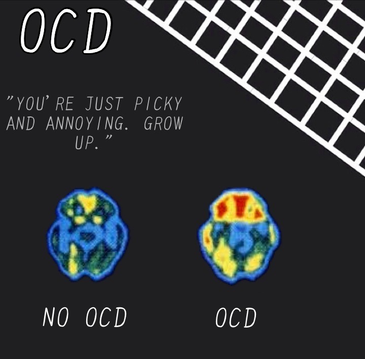 innocentpunkrockkids:
“ “The brain can get sick too."
Re-make of this post.
End mental health stigma.
”
Everyone should reblog