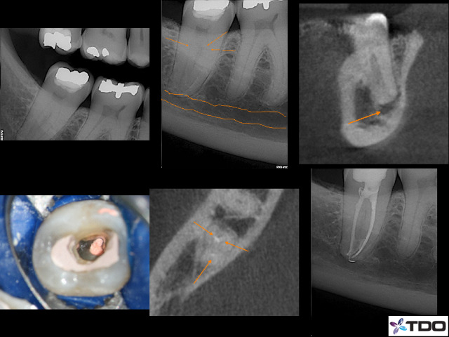 highfive endodontics