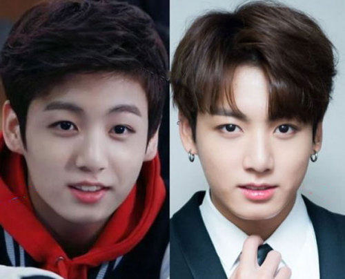Bts Before And After Plastic Surgery Korean Idol