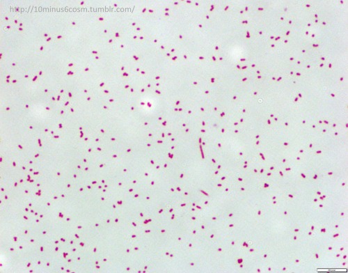 MICROCOSM | Smelling of Strawberries: Dysgonomonas species