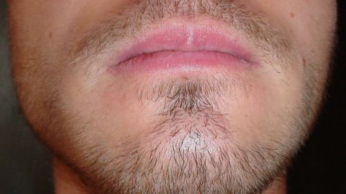 Body Hair Growth Pre Minoxidil