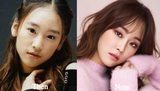 My Cosmetic Surgery Journey — Seo Hyun Jin Plastic Surgery Rumors