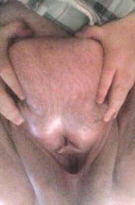 atldirtybirdsfan:bbwasshole:Beautiful fat pussyHoly...