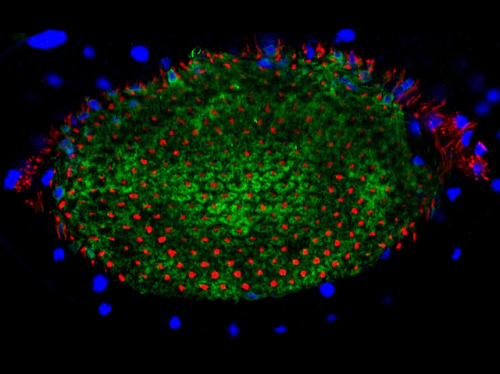 bpod-mrc: Good Optics Think of the brain and you might think...