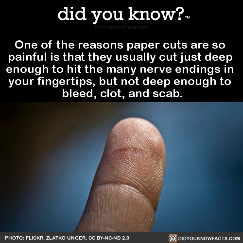 did-you-kno:One of the reasons paper cuts are so painful is...