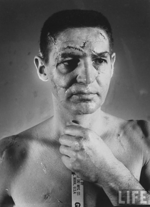 purpwashere:The face of hockey goalie Terry Sawchuk, before...