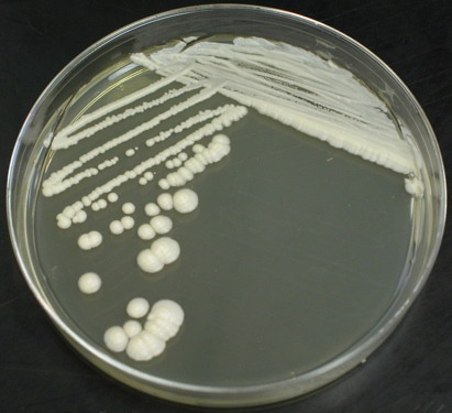 saccharomyces cerevisiae on Tumblr